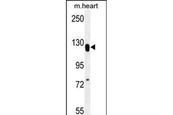 MED14 antibody  (AA 586-615)