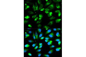 Immunofluorescence analysis of HeLa cells using ARHGDIA antibody.
