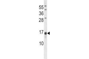 Western Blotting (WB) image for anti-Osteocalcin (BGLAP) antibody (ABIN3001265)