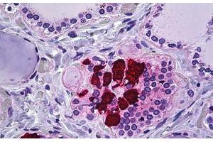 Human Thyroid, C-cells: Formalin-Fixed, Paraffin-Embedded (FFPE) (CIB2 antibody  (AA 21-70))