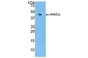 Detection of Recombinant C3, Human using Polyclonal Antibody to Complement Component 3 (C3) (C3 antibody  (AA 1000-1326))