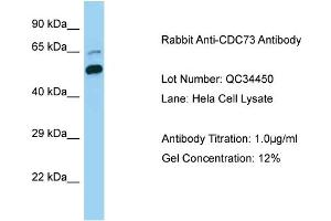 Host: Rabbit Target Name: CDC73 Sample Type: Human Hela Cell Antibody Dilution: 1.