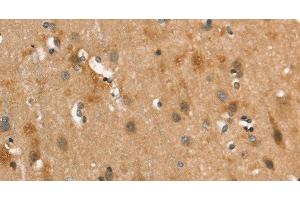Immunohistochemistry of paraffin-embedded Human brain using CALCRL Polyclonal Antibody at dilution of 1:40 (CALCRL antibody)