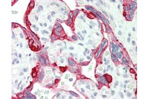 Human Placenta: Formalin-Fixed, Paraffin-Embedded (FFPE). (RNF11 antibody  (AA 75-124))