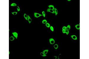 Detection of GCLM in MCF7 cells using Polyclonal Antibody to Glutamate Cysteine Ligase, Modifier Subunit (GCLM) (GCLM antibody  (AA 40-251))