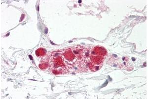 Image no. 2 for anti-Discs, Large Homolog 4 (Drosophila) (DLG4) (AA 683-732) antibody (ABIN6749749) (DLG4 antibody  (AA 683-732))