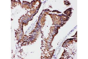 Immunohistochemistry (IHC) image for anti-Transcription Factor A, Mitochondrial (TFAM) (AA 227-246), (C-Term) antibody (ABIN3044014)