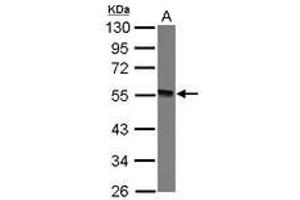 Image no. 1 for anti-Glycosyltransferase-Like Domain Containing 1 (GTDC1) (AA 1-164) antibody (ABIN1498562)