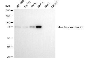 Western blotting analysis using forkhead box P1 antibody (ABIN7798651). (FOXP1 antibody)