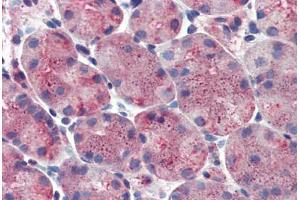 Stomach: Formalin-Fixed, Paraffin-Embedded (FFPE) (ERP44 antibody  (Internal Region))