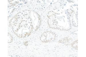 anti-Bromodomain Containing 7 (BRD7) (AA 601-651) antibody