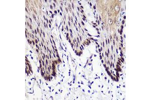Immunohistochemistry (IHC) image for anti-Transketolase (TKT) (AA 1-280) antibody (ABIN6149201)