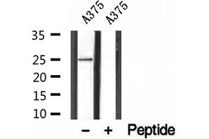 Western blot analysis of extracts of A375 cells, using ALR antibody. (GFER antibody  (C-Term))
