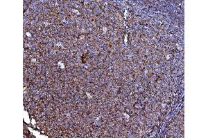 IHC analysis of CD40/TNFRSF5 using anti-CD40/TNFRSF5 antibody (ABIN4886525). (CD40 antibody  (AA 21-193))