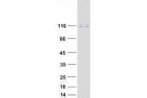 Validation with Western Blot