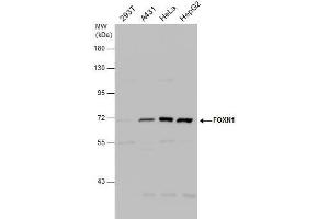 WB Image FOXN1 antibody [C3], C-term detects FOXN1 protein by western blot analysis. (FOXN1 antibody  (C-Term))