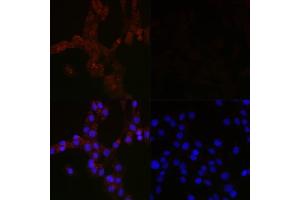 Immunofluorescence analysis of C6 cells using MLC3B Mouse mAb (ABIN7268520) at dilution of 1:100 (40x lens). (LC3B antibody)