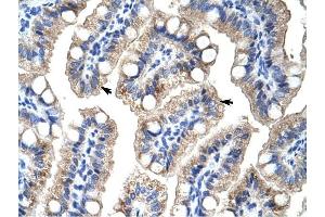 ZNF785 antibody was used for immunohistochemistry at a concentration of 4-8 ug/ml to stain Epithelial cells of intestinal villus (arrows) in Human intestine.