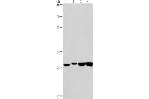 Gel: 8 % SDS-PAGE, Lysate: 40 μg, Lane 1-4: Humna colon cancer tissue, mouse kidney tissue, mouse testis tissue, human fetal brain tissue, Primary antibody: ABIN7130004(KLF7 Antibody) at dilution 1/483. (KLF7 antibody)