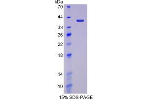 Image no. 1 for Lactate Dehydrogenase C (LDHC) (AA 1-332) protein (His tag) (ABIN4990170)