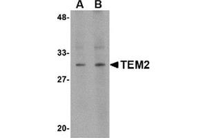Western blot analysis of TEM2 in human colon tissue lysate with this product at (A) 1 and (B) 2 μg/ml. (RASD2 antibody  (C-Term))