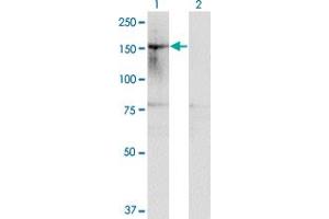 Western Blot analysis of HDAC6 expression in transfected 293T cell line by HDAC6 monoclonal antibody (M01), clone 1E2. (HDAC6 antibody  (AA 1128-1215))