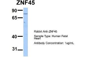 Host:  Rabbit  Target Name:  ZNF45  Sample Type:  Human Fetal Heart  Antibody Dilution:  1.