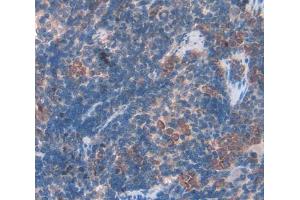 Used in DAB staining on fromalin fixed paraffin- embedded Kidney tissue (BAFF antibody  (AA 21-169))