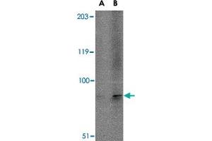 Western blot analysis of TMC6 in A-20 cell lysate with TMC6 polyclonal antibody  at (A) 1 and (B) 2 ug/mL . (TMC6 antibody  (N-Term))