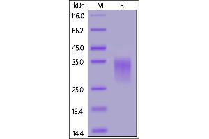 Rat 4-1BB, His Tag on  under reducing (R) condition. (CD137 Protein (AA 24-187) (His tag))