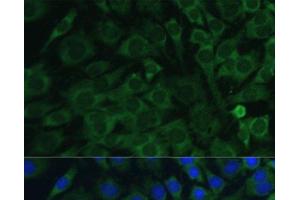 Immunofluorescence analysis of C6 cells using OSM Polyclonal Antibody at dilution of 1:100. (Oncostatin M antibody)