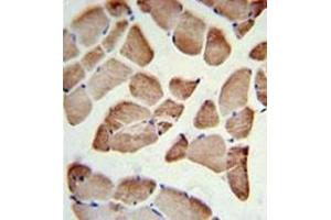 Immunohistochemistry analysis in formalin fixed and paraffin embedded skeletal muscle reacted with LFNG Antibody (Center) followed by peroxidase conjugation of the secondary antibody and DAB staining.
