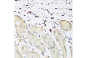 Immunohistochemistry of paraffin-embedded human stomach using PLEK antibody (ABIN6290796) at dilution of 1:200 (40x lens).