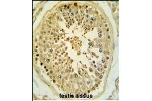 Formalin-fixed and paraffin-embedded human testis tissue reacted with LMX1B Antibody (Center), which was peroxidase-conjugated to the secondary antibody, followed by DAB staining. (LMX1B antibody  (AA 175-202))