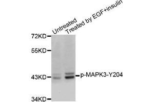 Western blot analysis of extracts from SK-BR-3 cells, using Phospho-MAPK3-Y204 antibody.