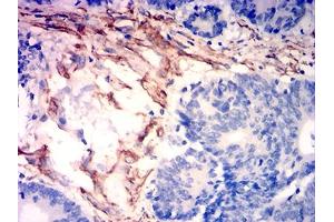 Immunohistochemistry (IHC) image for anti-Caldesmon 1 (CALD1) (AA 26-207) antibody (ABIN7193477)