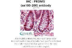 Image no. 1 for anti-PR Domain Containing 5 (PRDM5) (AA 100-200) antibody (ABIN1738318)