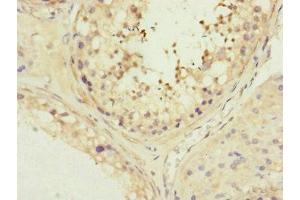 Immunohistochemistry of paraffin-embedded human testis tissue using ABIN7159966 at dilution of 1:100 (MFN1 antibody  (AA 622-741))