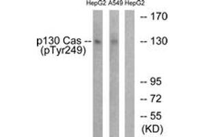Western blot analysis of extracts from HepG2 cells treated with EGF 200ng/ml 30' and A549 cells treated with PMA 125ng/ml 30', using p130 Cas (Phospho-Tyr249) Antibody. (BCAR1 antibody  (pTyr249))