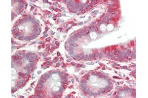 Human Small Intestine: Formalin-Fixed, Paraffin-Embedded (FFPE) (EIF3B antibody  (AA 100-150))