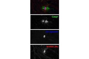 Adult rat sciatic nerve immuno-fluorescence staining: paranodes labeled with Caspr (green) surround nodes of Ranvier labeled with Beta-IV spectrin (blue) and N168/6 (red).