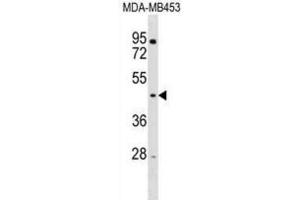 Western Blotting (WB) image for anti-Ring Finger Protein 128 (RNF128) antibody (ABIN3000884) (RNF128 antibody)