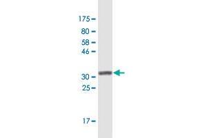 Western Blot detection against Immunogen (36. (ZIC1 antibody  (AA 2-95))