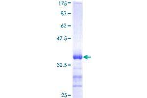 RNF144B Protein (AA 1-100) (GST tag)