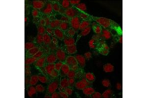 Immunofluorescence staining of PFA-fixed HepG2 cells with Catenin, gamma Mouse Monoclonal Antibody (rCTNG/1664) followed by goat anti-Mouse IgG-CF488 (Green).