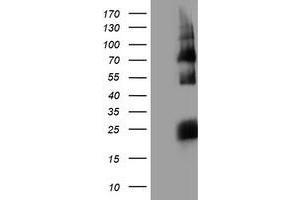 HEK293T cells were transfected with the pCMV6-ENTRY control (Left lane) or pCMV6-ENTRY HARS2 (Right lane) cDNA for 48 hrs and lysed. (HARS2 antibody)