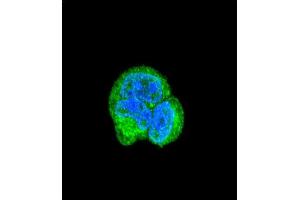 Confocal immunofluorescent analysis of AS Antibody (N-term) (ABIN390843 and ABIN2841069) with MCF-7 cell followed by Alexa Fluor® 488-conjugated goat anti-rabbit lgG (green). (ASPA antibody  (N-Term))