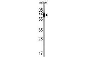 Image no. 1 for anti-Albumin (ALB) (C-Term) antibody (ABIN452731) (Albumin antibody  (C-Term))