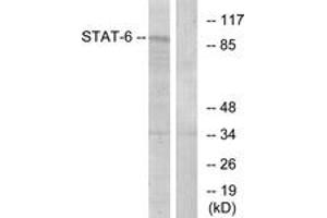 Western blot analysis of extracts from HeLa cells, using STAT6 (Ab-641) Antibody.