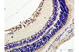 Formalin-fixed and paraffin embedded rat retina tissue labeled with Anti TIE2/CD202b Polyclonal Antibody, Unconjugated (ABIN674649) at 1:200 followed by conjugation to the secondary antibody and DAB staining (TEK antibody  (AA 401-550))